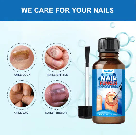 Sumifun – Nail Fungus Treatment Liquid سائل سوميفن لعلاج فطريات الأظافر